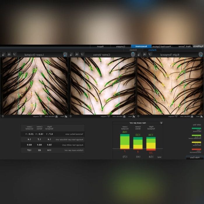 Digital Trichoscope 1