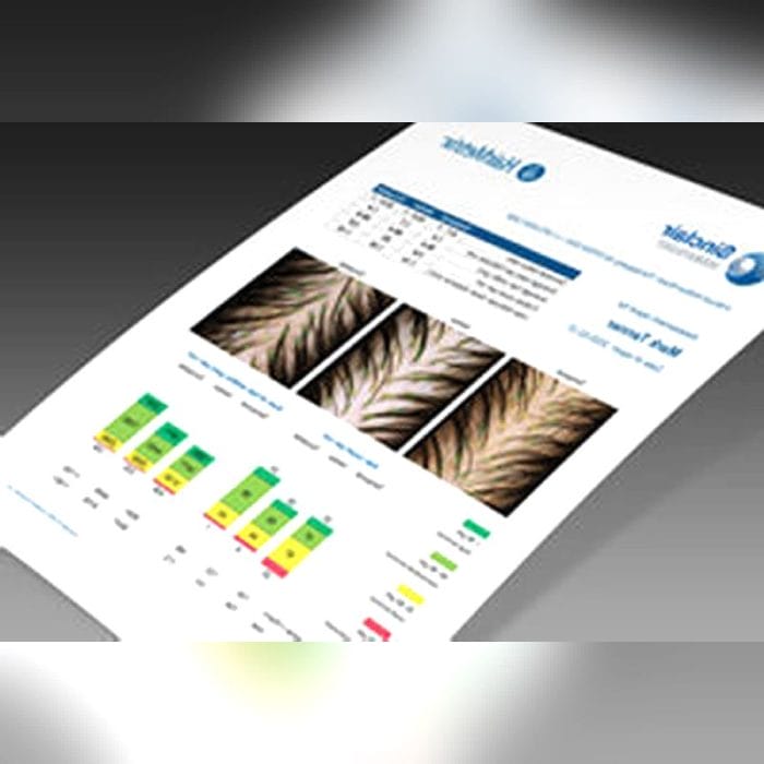 Digital Trichoscope 3