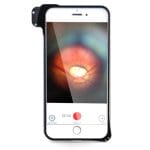 Direct Ophthalmoscope