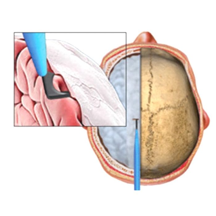 Dura Mater Surgical Knife 5