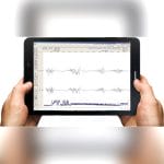 Ecg Patient Monitor 2