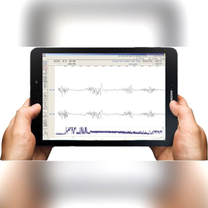 Ecg Patient Monitor 2