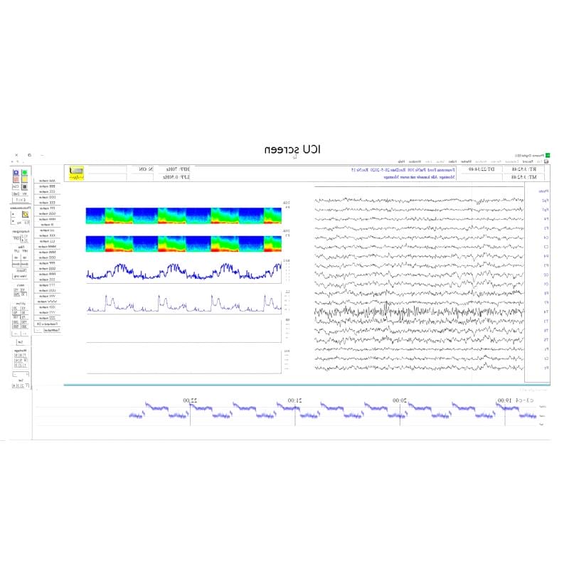 Ecg Patient Monitor 1