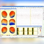 Eeg Amplifier 2