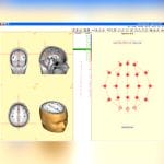 Eeg Amplifier 3