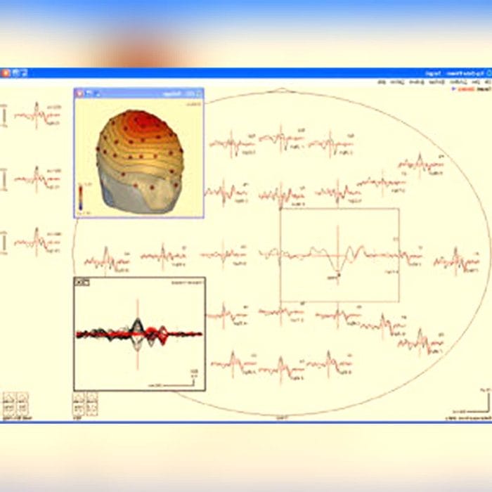 Eeg Amplifier 4