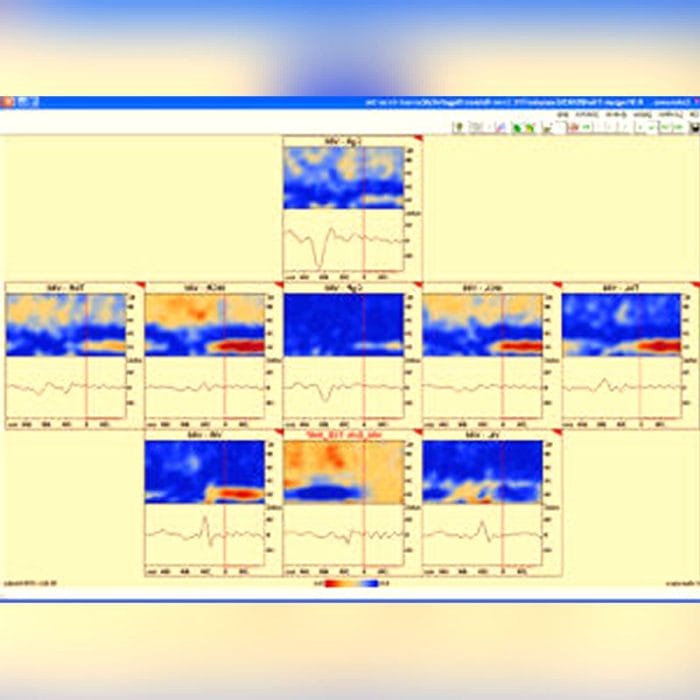 Eeg Amplifier 6