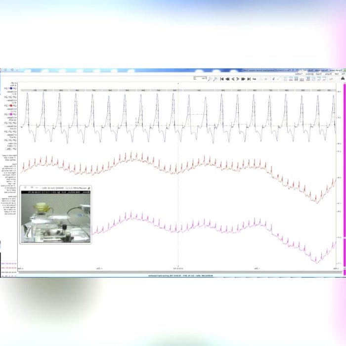 Eeg Software 1