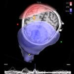 Eeg Software 1