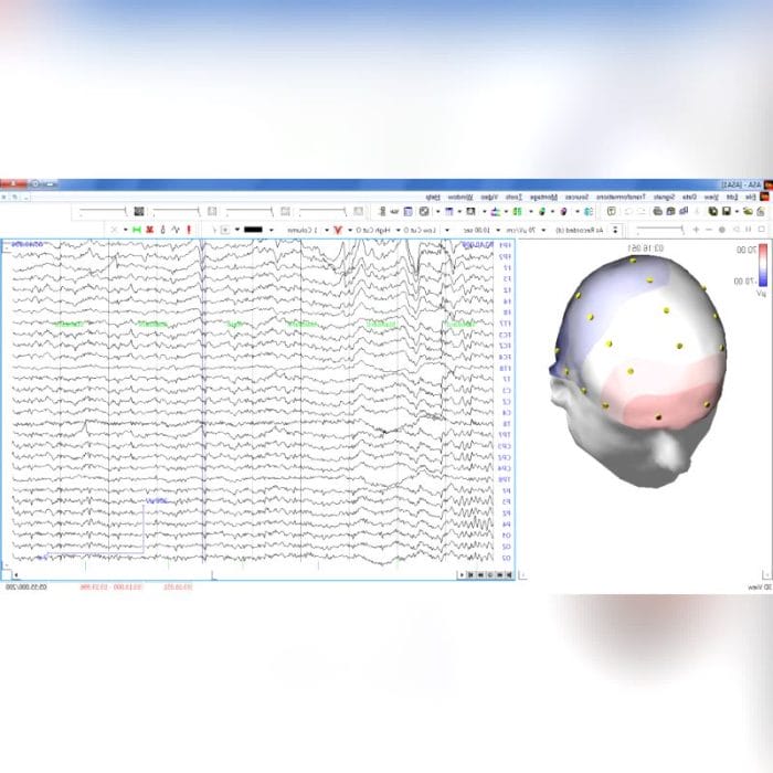 Eeg Software 4