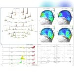 Eeg Software 5