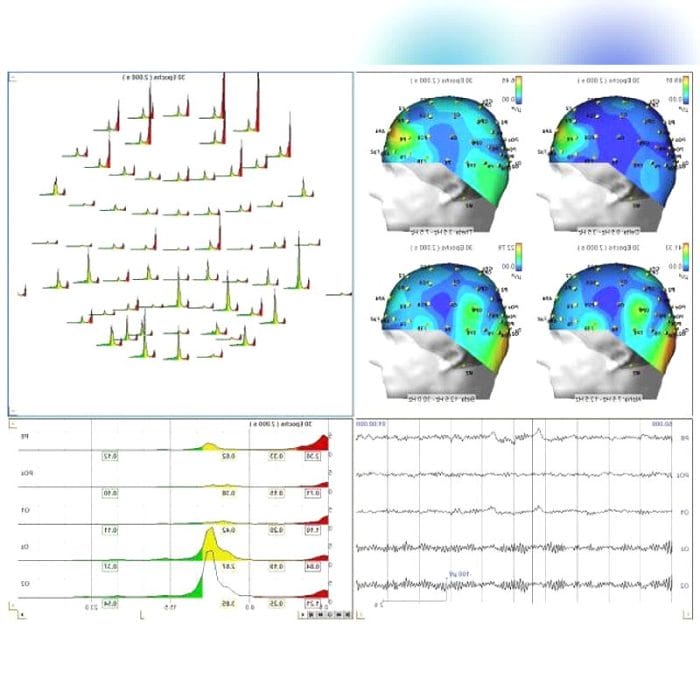 Eeg Software 5