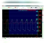 Electrophysiology Recording System 1