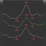 Electroretinograph 2