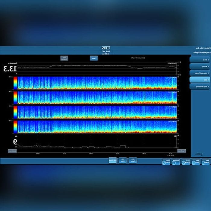 Emg Amplifier 1