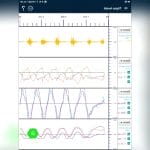 Emg Software Module 2