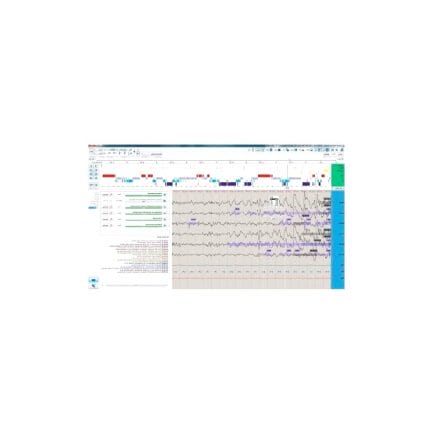 Emg Software Module