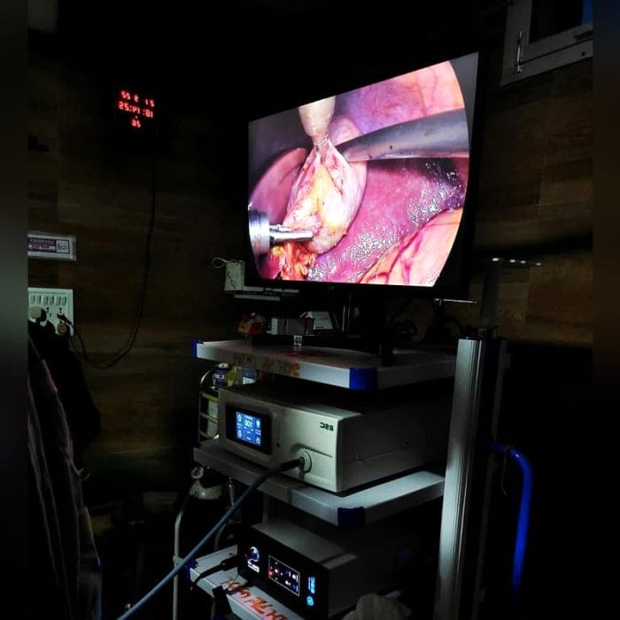 Endoscope Camera 5