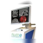 Ent Surgery Surgical Navigation System 1