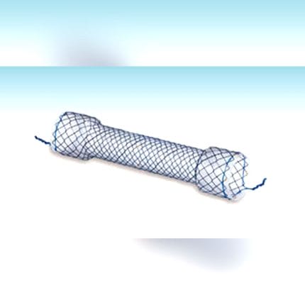 Esophageal Stent