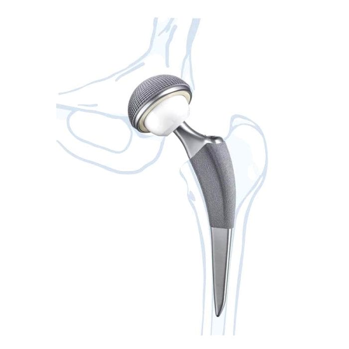 Femoral Head Prosthesis 1