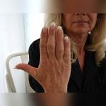 Finger Cosmetic Prosthesis 4