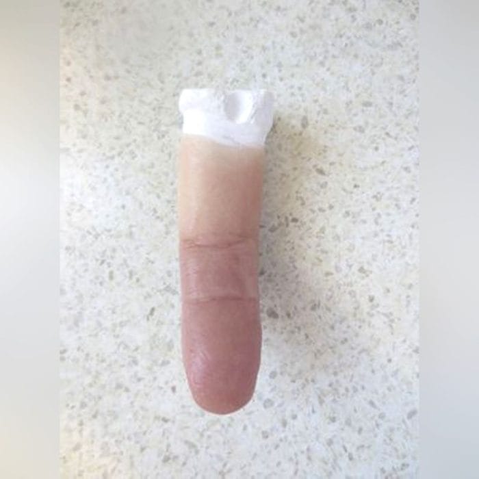 Finger Cosmetic Prosthesis 4