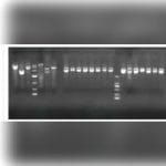 Fluorescence Gel Documentation System 1