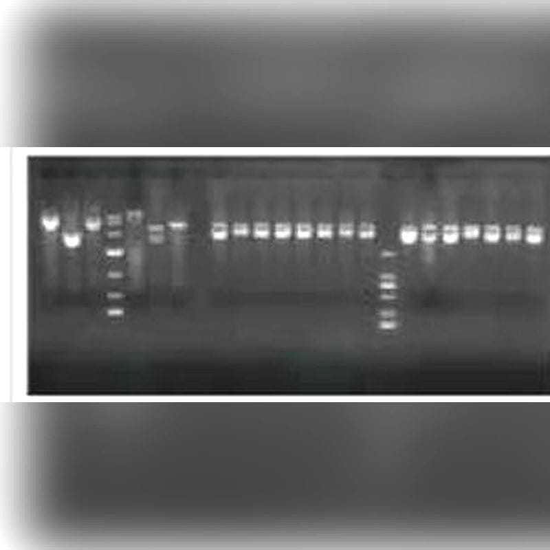 Fluorescence Gel Documentation System 1