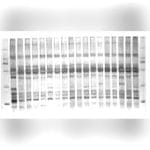 Fluorescence Gel Documentation System 3