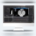 Fluorescence Preclinical Imaging System 3