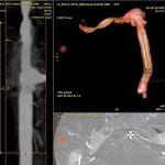 Fluoroscopy System 9