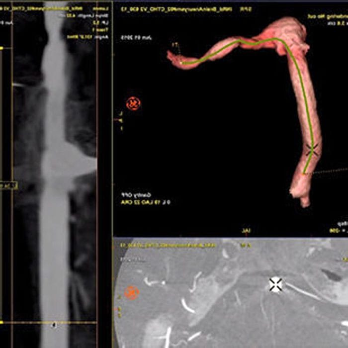 Fluoroscopy System 9