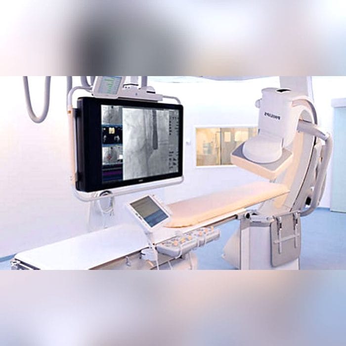 Fluoroscopy System