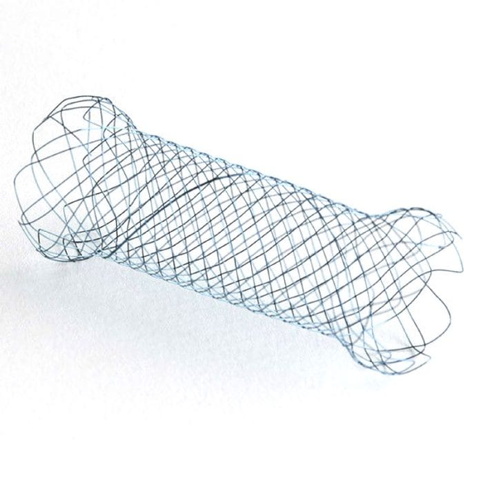 Gastric Stent 3