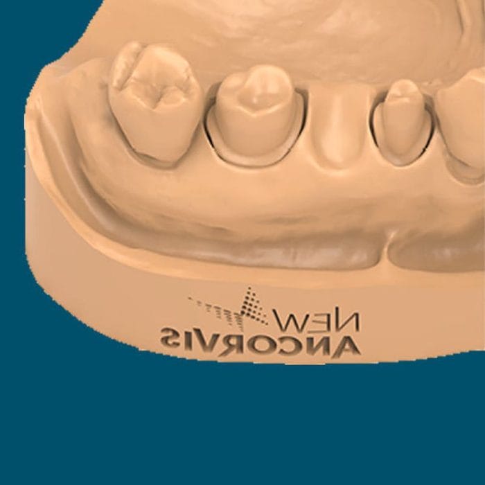 Gingival Anatomy Model 4