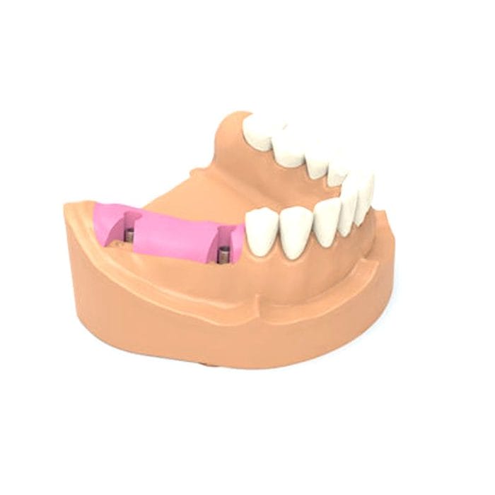 Gingival Anatomy Model 5