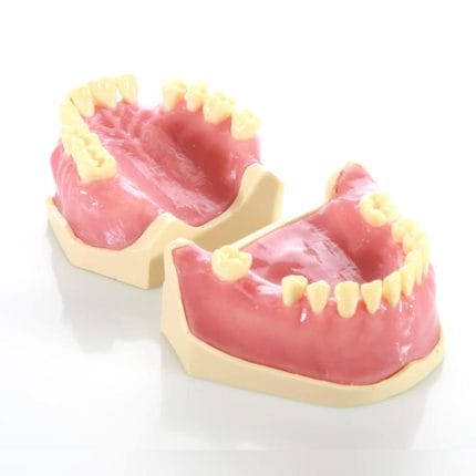 Gingival Model 1