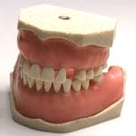 Gingival Model 2