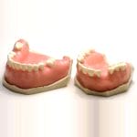 Gingival Model 4