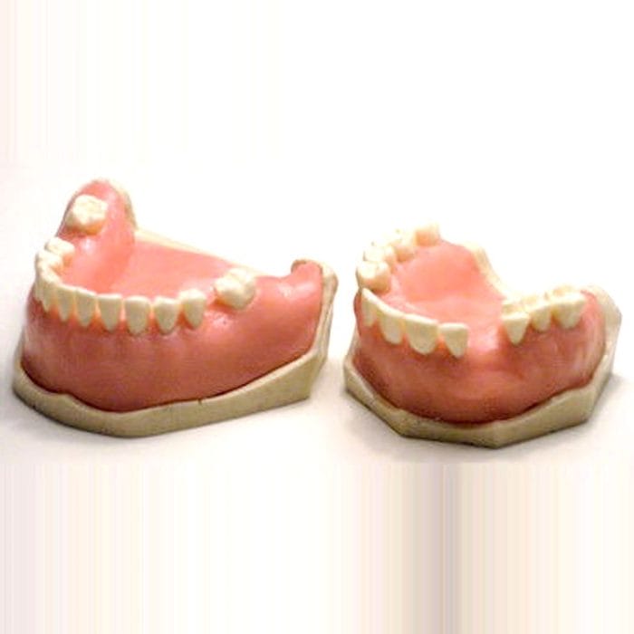 Gingival Model 4