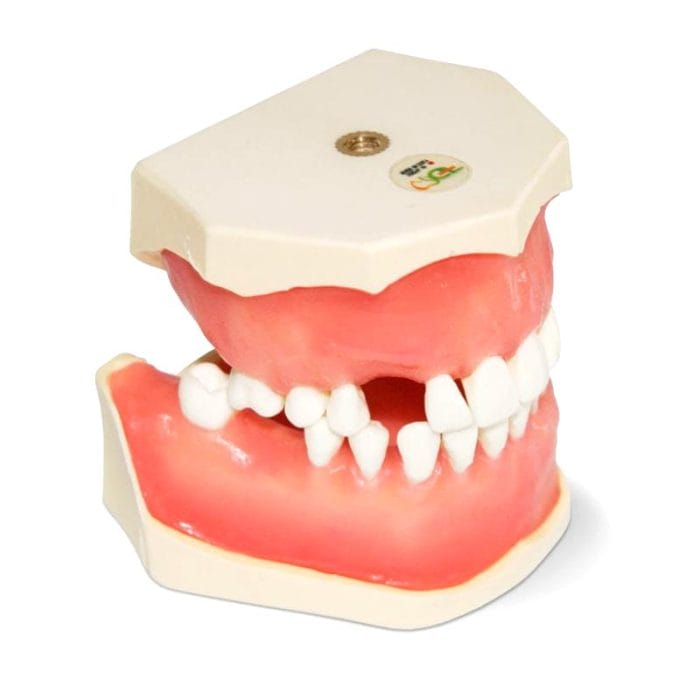 Gingival Model