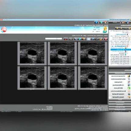 Gynecological Examination Software 1