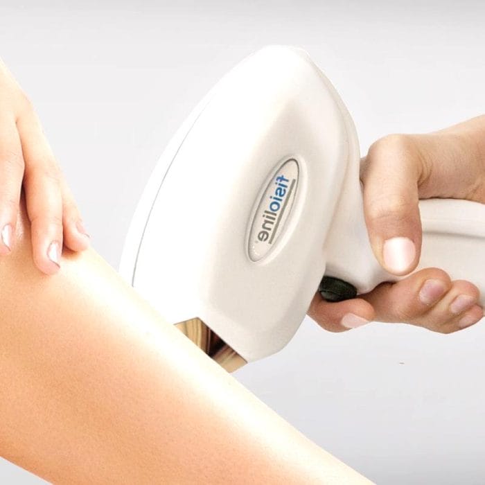 Hair Removal Laser 1