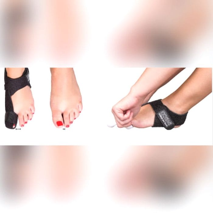 Hallux Valgus Orthosis 1