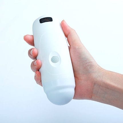 Hand-Held Bladder Scanner 1