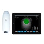 Hand-Held Bladder Scanner