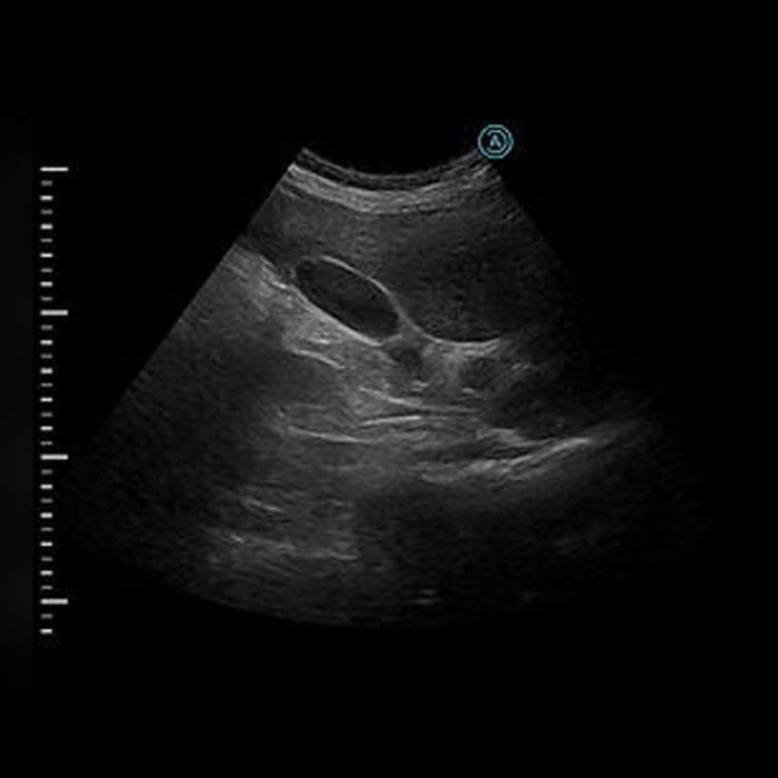 Hand-Held Ultrasound System 4