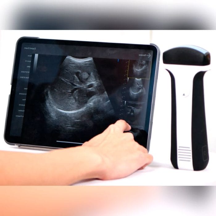 Hand-Held Ultrasound System