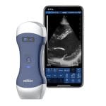 Hand-Held Ultrasound System